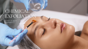 chemical exfoliation